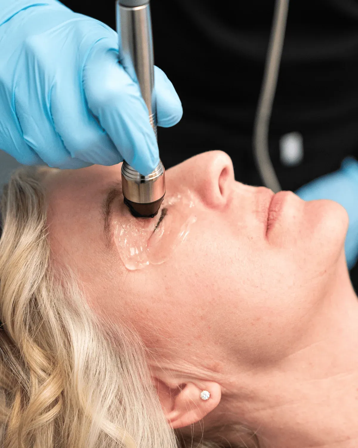 Forma-I Eye Treatment